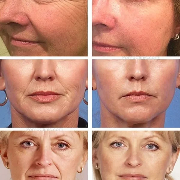 highprime collagen film 7